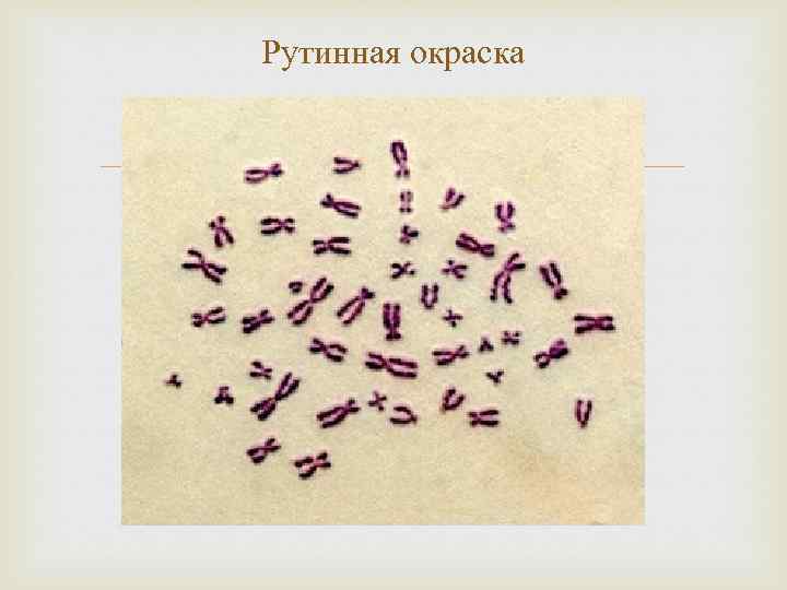 Рутинная окраска 
