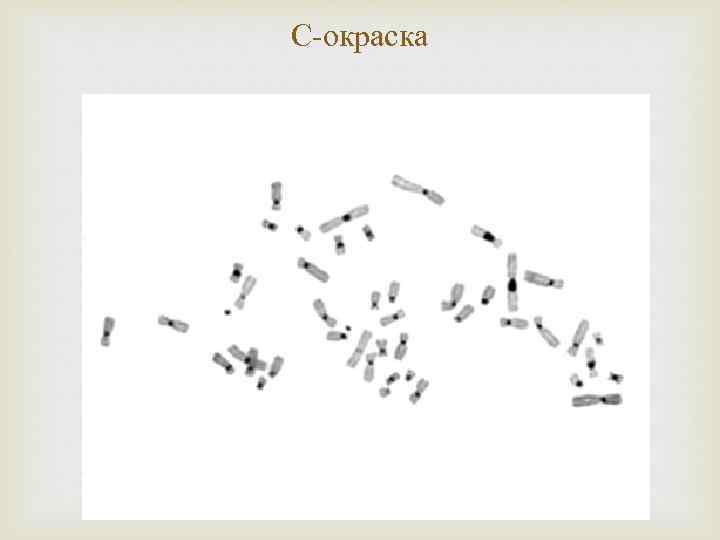 С-окраска 