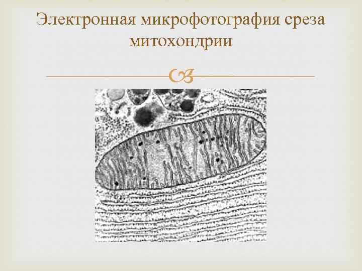 Какова функция органоида электронная микрофотография которого представлена на рисунке