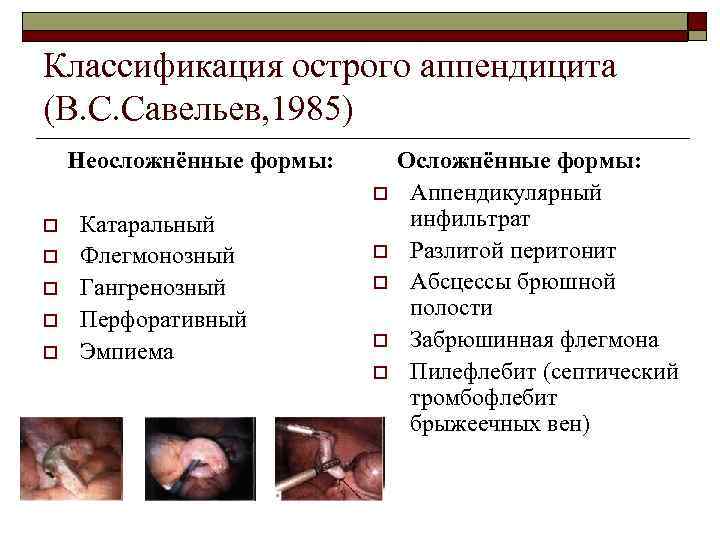 Классификация острого аппендицита (В. С. Савельев, 1985) Неосложнённые формы: o o o Катаральный Флегмонозный