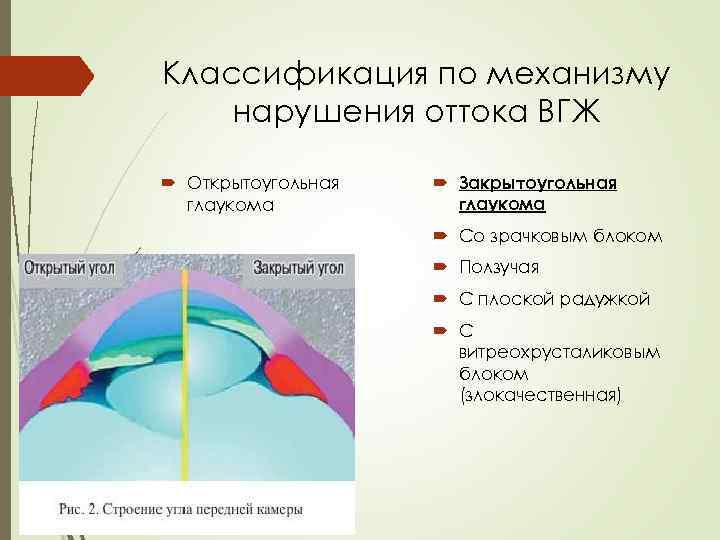 Для открытоугольной глаукомы характерны тест