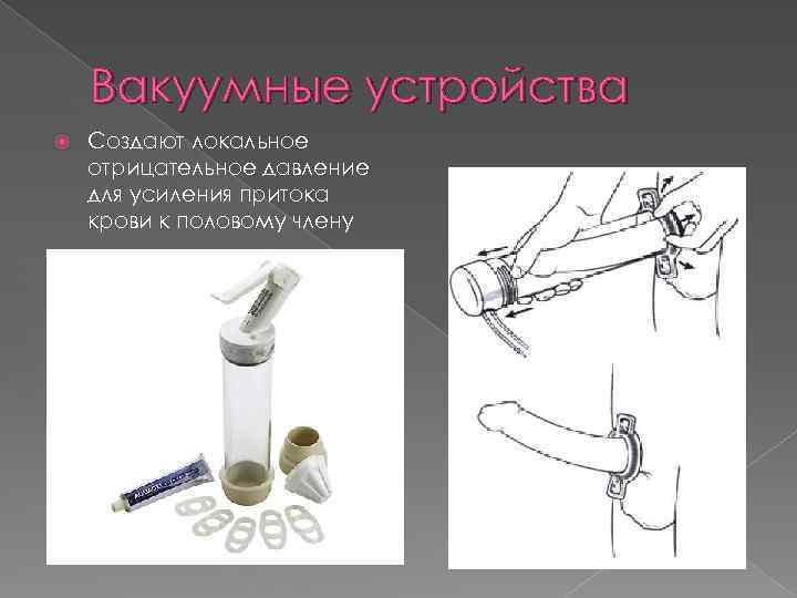 Вакуумные устройства Создают локальное отрицательное давление для усиления притока крови к половому члену 