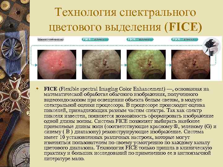 Технология спектрального цветового выделения (FICE) w FICE (Flexible spectral Imaging Color Enhancement) —, основанная