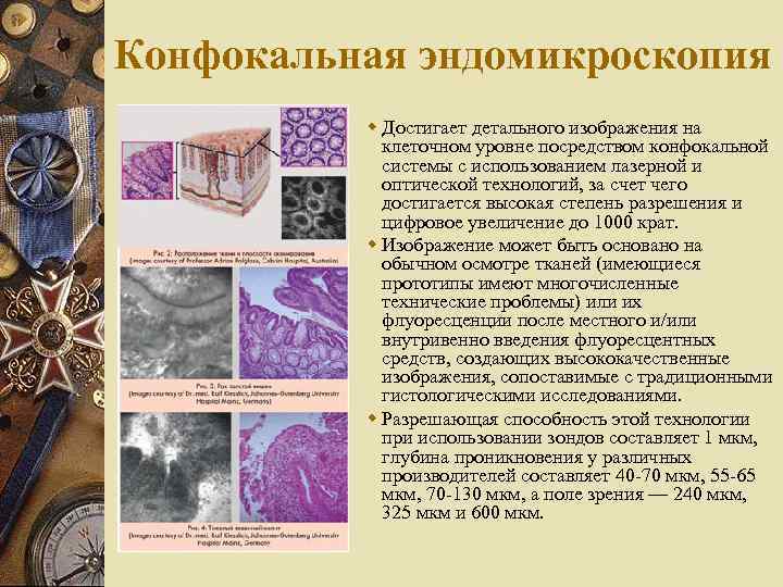 Конфокальная эндомикроскопия w Достигает детального изображения на клеточном уровне посредством конфокальной системы с использованием