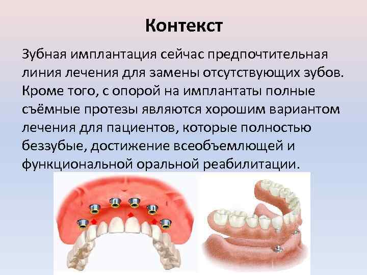 Контекст Зубная имплантация сейчас предпочтительная линия лечения для замены отсутствующих зубов. Кроме того, с