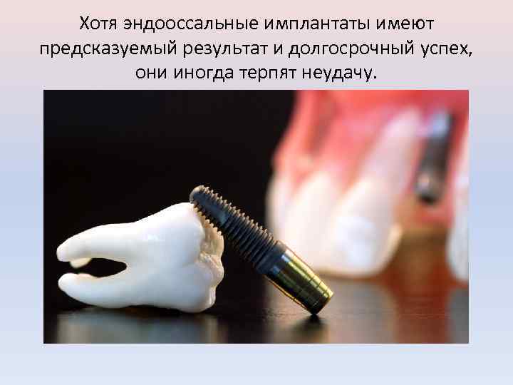 Хотя эндооссальные имплантаты имеют предсказуемый результат и долгосрочный успех, они иногда терпят неудачу. 