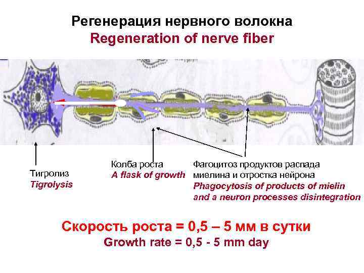 Регенерация нервного волокна Regeneration of nerve fiber Тигролиз Tigrolysis Колба роста Фагоцитоз продуктов распада