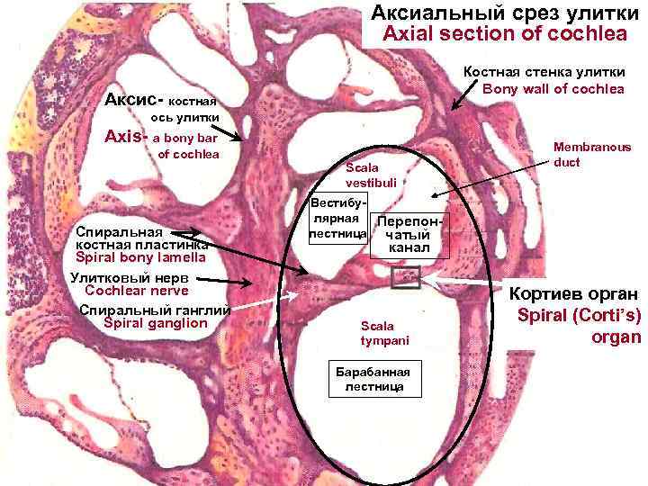 Аксиальный срез улитки Axial section of cochlea Костная стенка улитки Bony wall of cochlea