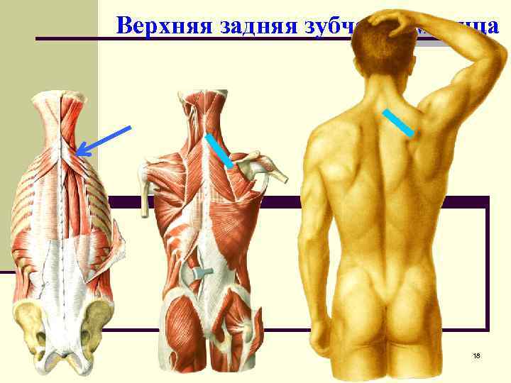 Зубчатые мышцы спины. Верхняя задняя зубчатая мышца. Задняя зубчатая мышца спины. Верхняя и нижняя зубчатые мышцы спины. Верхняя зубчатая мышца спины.