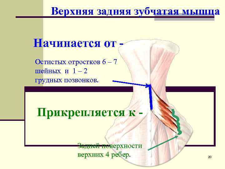 Задняя зубчатая. Верхняя задняя зубчатая мышца. Верхняя задняя зубчатая мышца прикрепляется к. Верхняя задняя зубчатая мышца начало. Верхняя задняя зубчатая мышца спины.