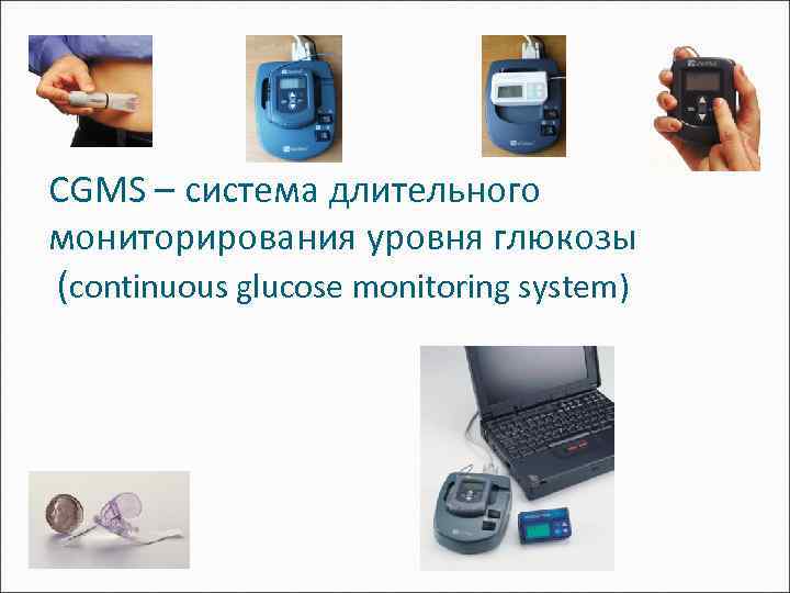 CGMS – система длительного мониторирования уровня глюкозы (continuous glucose monitoring system) 