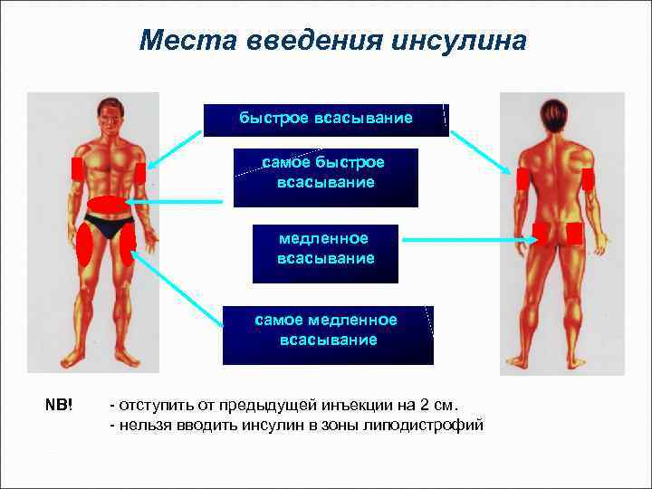 Места введения инсулина быстрое всасывание самое быстрое всасывание медленное всасывание самое медленное всасывание NB!