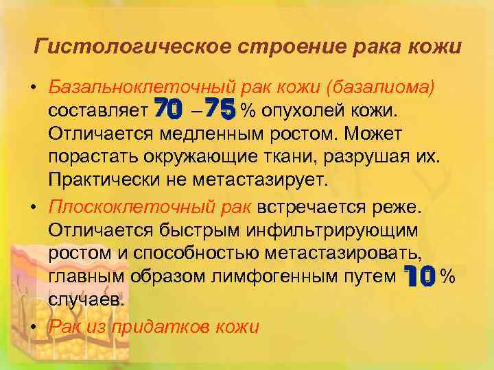 Гистологическое строение рака кожи • Базальноклеточный рак кожи (базалиома) составляет – % опухолей кожи.