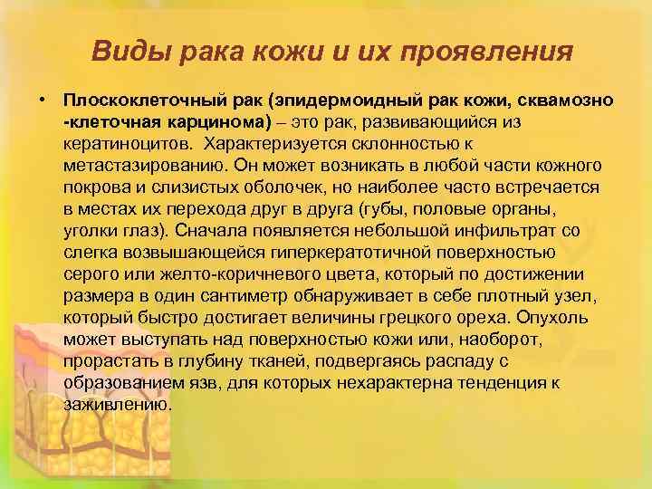 Виды рака кожи и их проявления • Плоскоклеточный рак (эпидермоидный рак кожи, сквамозно -клеточная