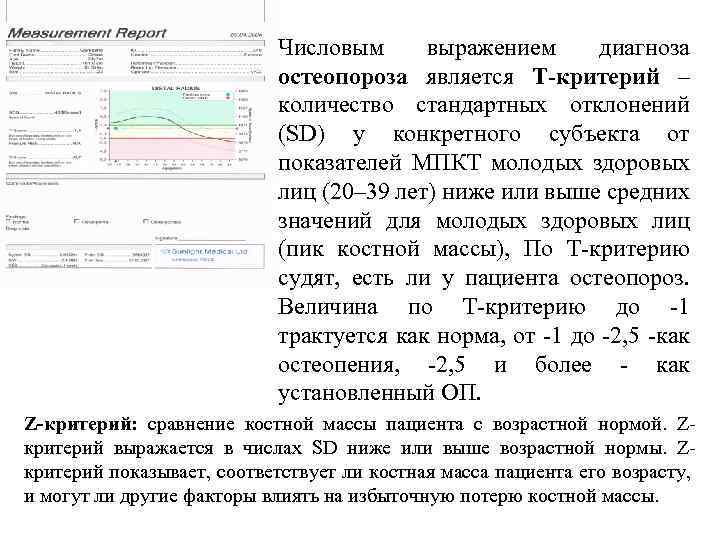 Числовым выражением диагноза остеопороза является Т-критерий – количество стандартных отклонений (SD) у конкретного субъекта