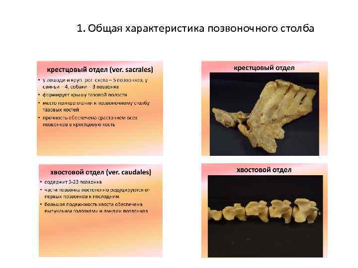 1. Общая характеристика позвоночного столба 