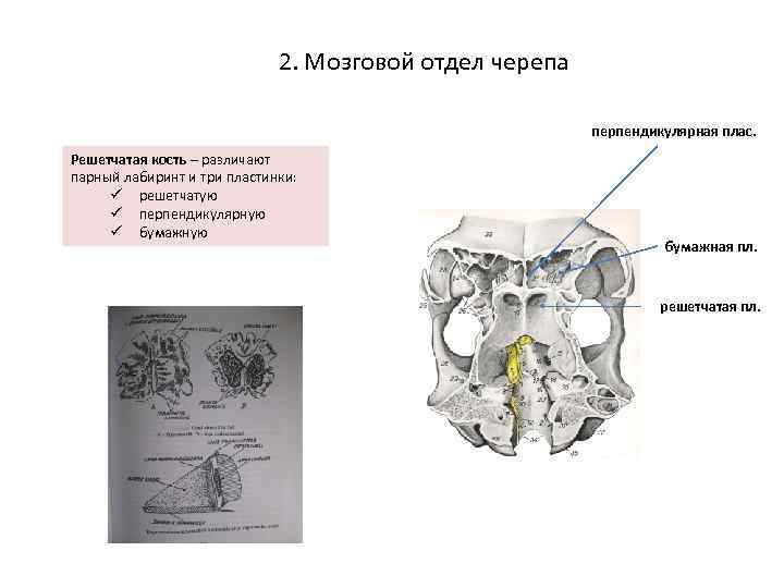 Решетчатая кость мозгового черепа. Мозговой отдел черепа решетчатая кость. Парный решетчатый Лабиринт решетчатая кость. Перпендикулярная пластинка решетчатой кости на кт. Бумажная пластинка решетчатой кости.