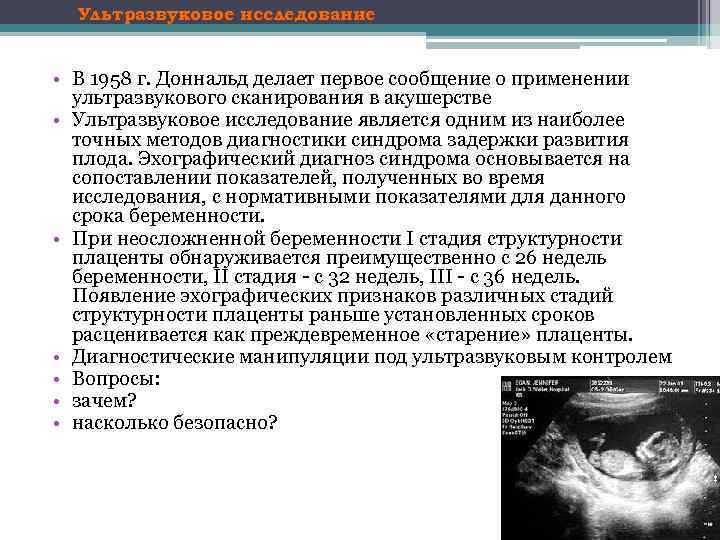 Ультразвуковое исследование • В 1958 г. Доннальд делает первое сообщение о применении ультразвукового сканирования