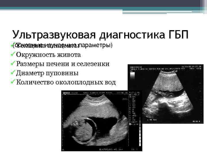 Ультразвуковая диагностика ГБП (основные изучаемые P Толщина плацентыпараметры) P Окружность живота P Размеры печени