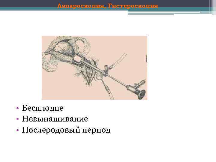 Лапароскопия, Гистероскопия • Бесплодие • Невынашивание • Послеродовый период 
