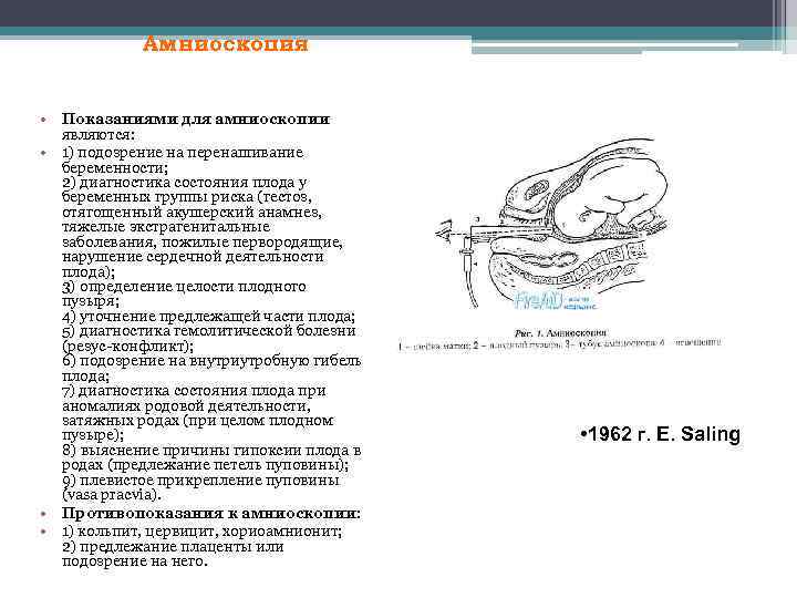 Амниоскопия • Показаниями для амниоскопии являются: • 1) подозрение на перенашивание беременности; 2) диагностика