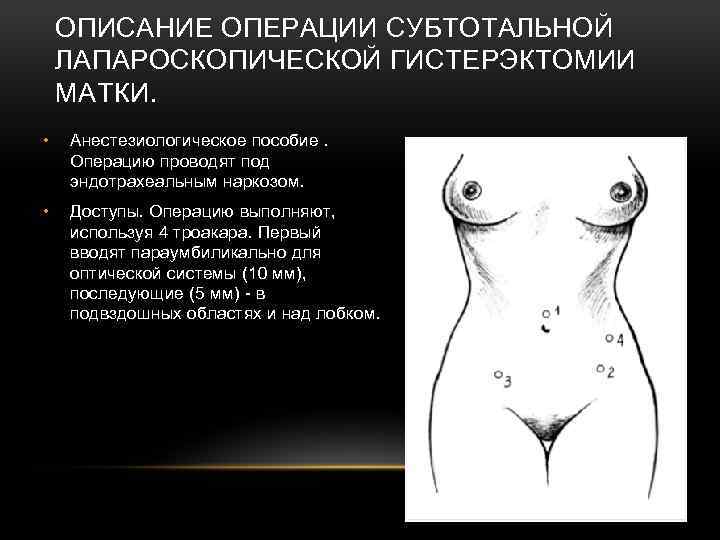 ОПИСАНИЕ ОПЕРАЦИИ СУБТОТАЛЬНОЙ ЛАПАРОСКОПИЧЕСКОЙ ГИСТЕРЭКТОМИИ МАТКИ. • Анестезиологическое пособие. Операцию проводят под эндотрахеальным наркозом.