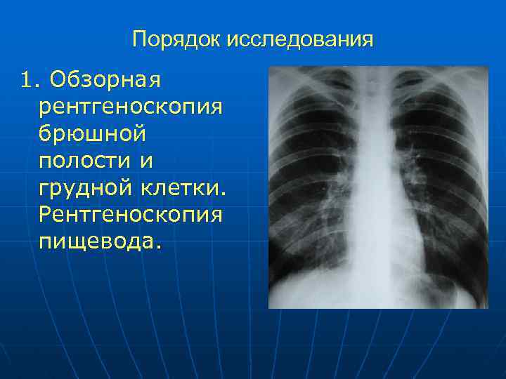 Порядок исследования 1. Обзорная рентгеноскопия брюшной полости и грудной клетки. Рентгеноскопия пищевода. 