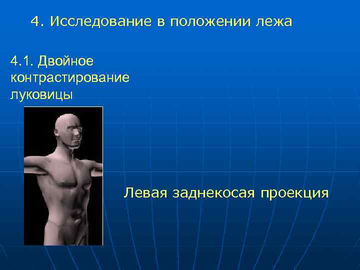 4. Исследование в положении лежа 4. 1. Двойное контрастирование луковицы Левая заднекосая проекция 