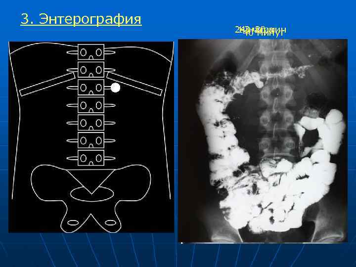 Рентгеноанатомия жкт презентация