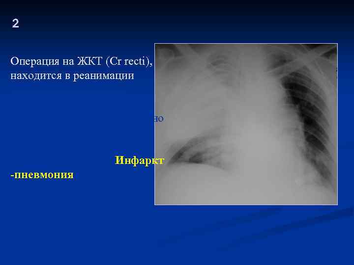 2 Операция на ЖКТ (Cr recti), находится в реанимации Кровохарканье, боли в грудной клетке,