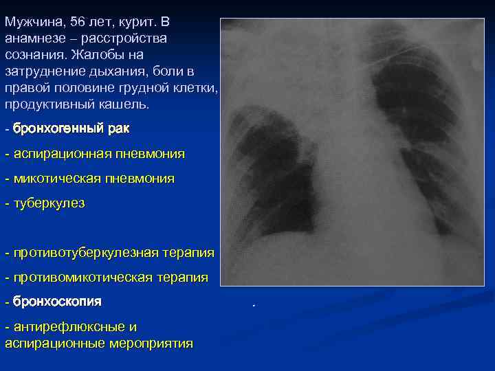 Мужчина, 56 лет, курит. В анамнезе – расстройства сознания. Жалобы на затруднение дыхания, боли