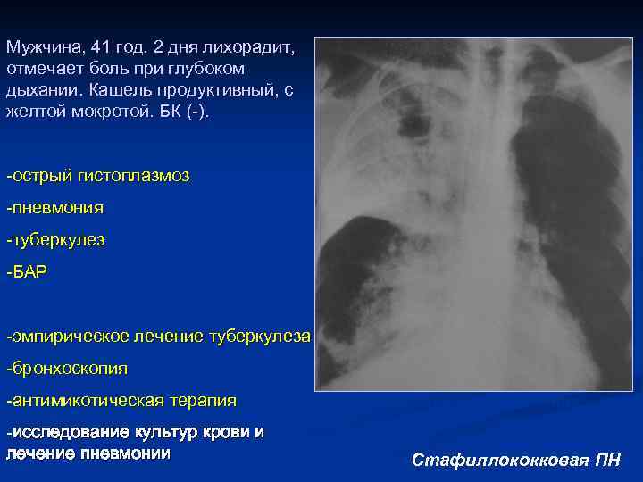Мужчина, 41 год. 2 дня лихорадит, отмечает боль при глубоком дыхании. Кашель продуктивный, с