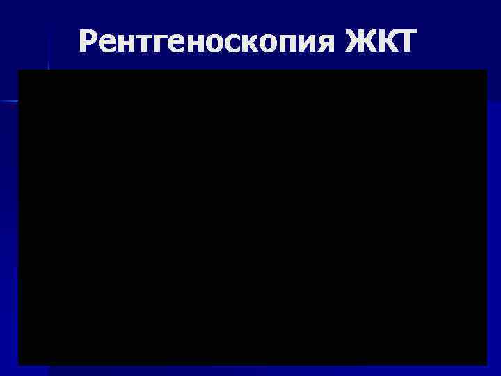 Рентгеноскопия ЖКТ 