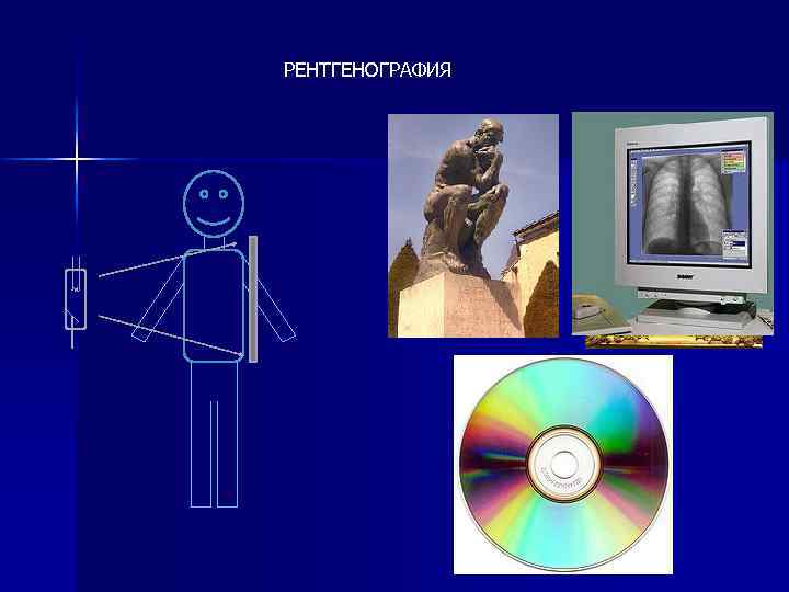 РЕНТГЕНОГРАФИЯ 