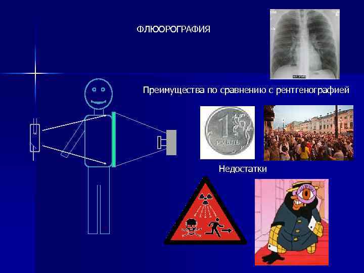 ФЛЮОРОГРАФИЯ Преимущества по сравнению с рентгенографией Недостатки 