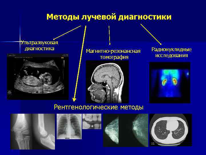 Методы лучевой диагностики. Лучевая диагностика методы лучевой диагностики. Рентгенологический способ лучевой диагностики. Рентгеновский метод лучевая диагностика. Методы исследования в лучевой диагностике.