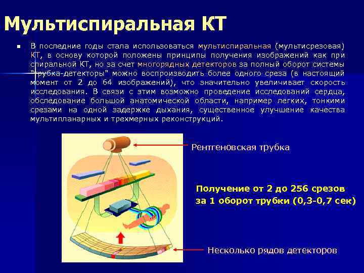 Мультиспиральная КТ n В последние годы стала использоваться мультиспиральная (мультисрезовая) КТ, в основу которой