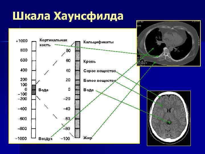 Шкала аспектс