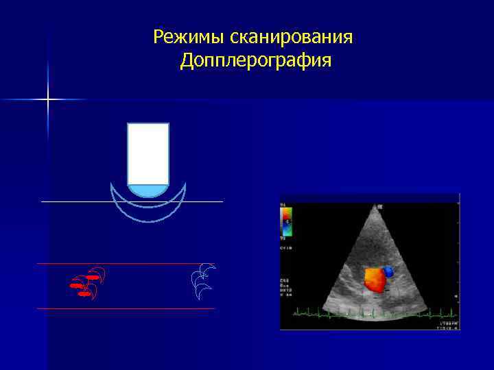 Режимы сканирования Допплерография 