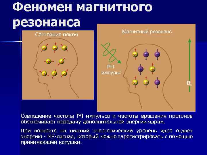 Феномен магнитного резонанса Состояние покоя Совпадение частоты РЧ импульса и частоты вращения протонов обеспечивает