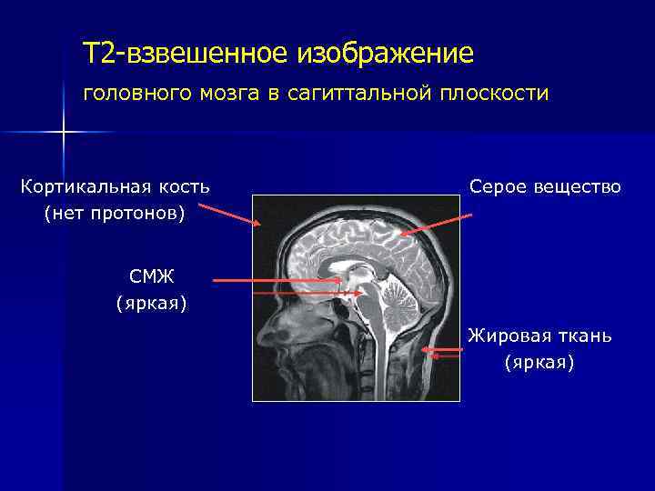 Взвешенное изображение мрт