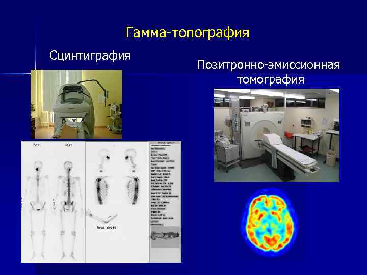 Эмиссионный характер получения лучевого изображения