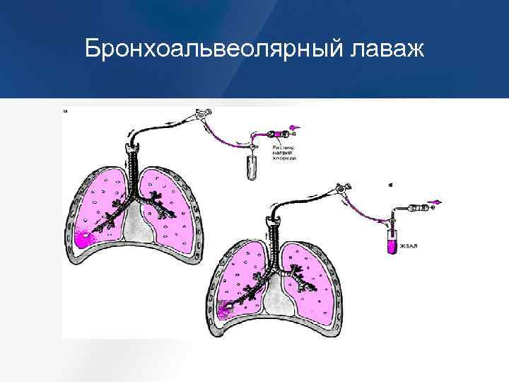 Почесуха взрослых дифференциальная диагностика фото