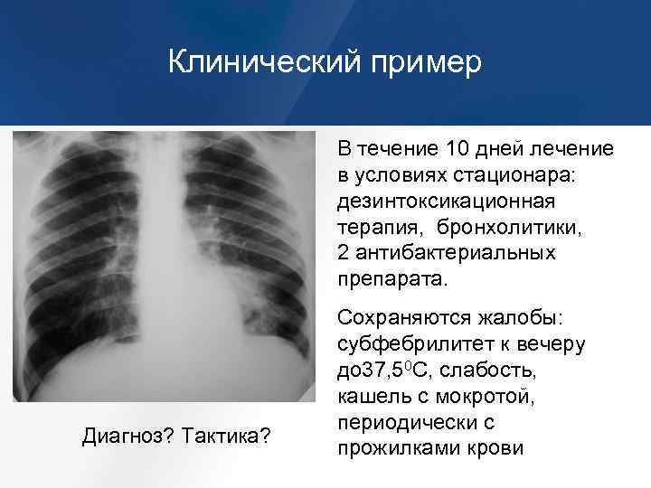 Клинический пример В течение 10 дней лечение в условиях стационара: дезинтоксикационная терапия, бронхолитики, 2