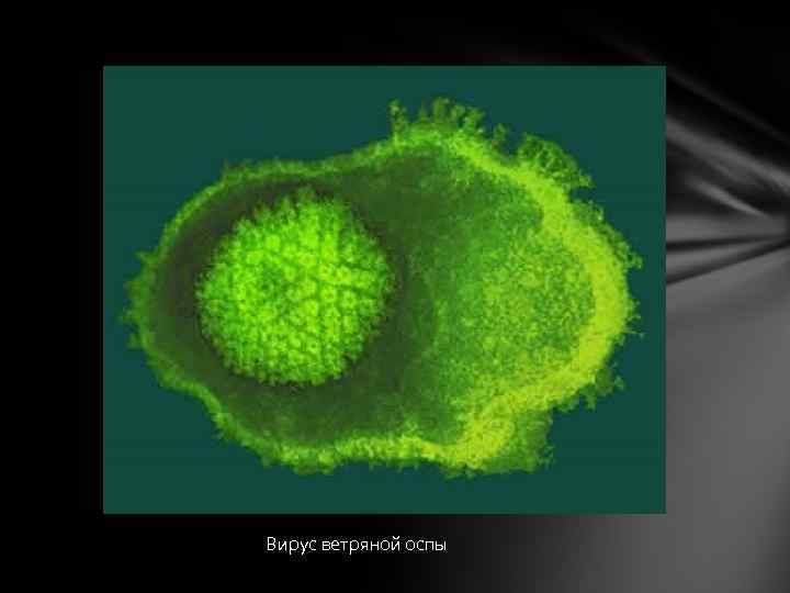 Вирус ветряной оспы 