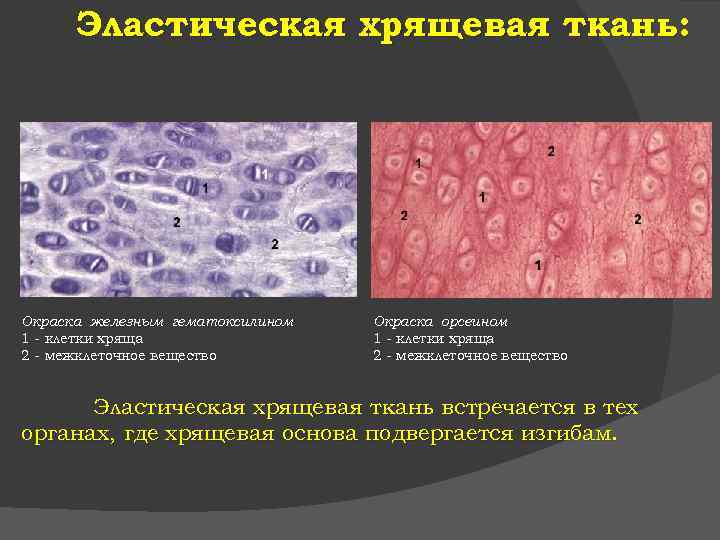 Эластическая хрящевая ткань: Окраска железным гематоксилином 1 - клетки хряща 2 - межклеточное вещество