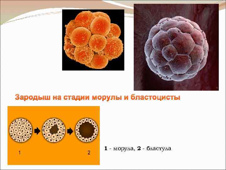 Строение женской репродуктивной системы в картинках