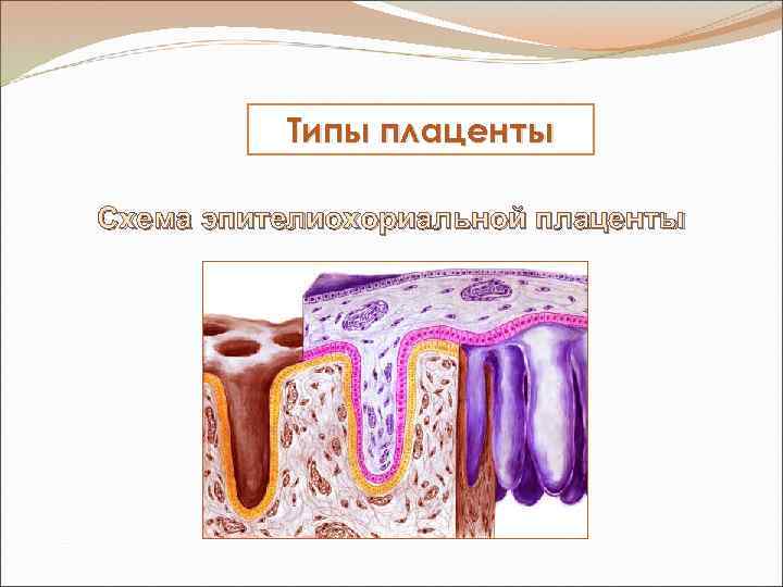 Типы плаценты Схема эпителиохориальной плаценты 