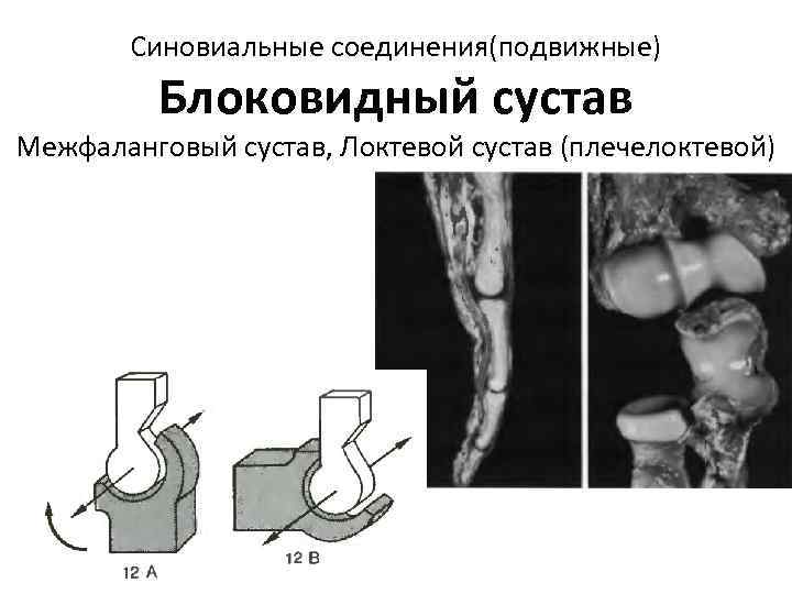 Синовиальные соединения(подвижные) Блоковидный сустав Межфаланговый сустав, Локтевой сустав (плечелоктевой) 