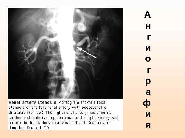 А н г и о г р а ф и я 
